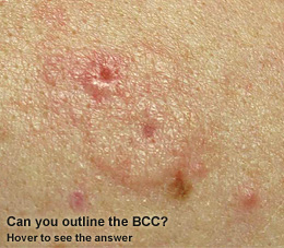 Can you outline the BCC? Hover to see the answer